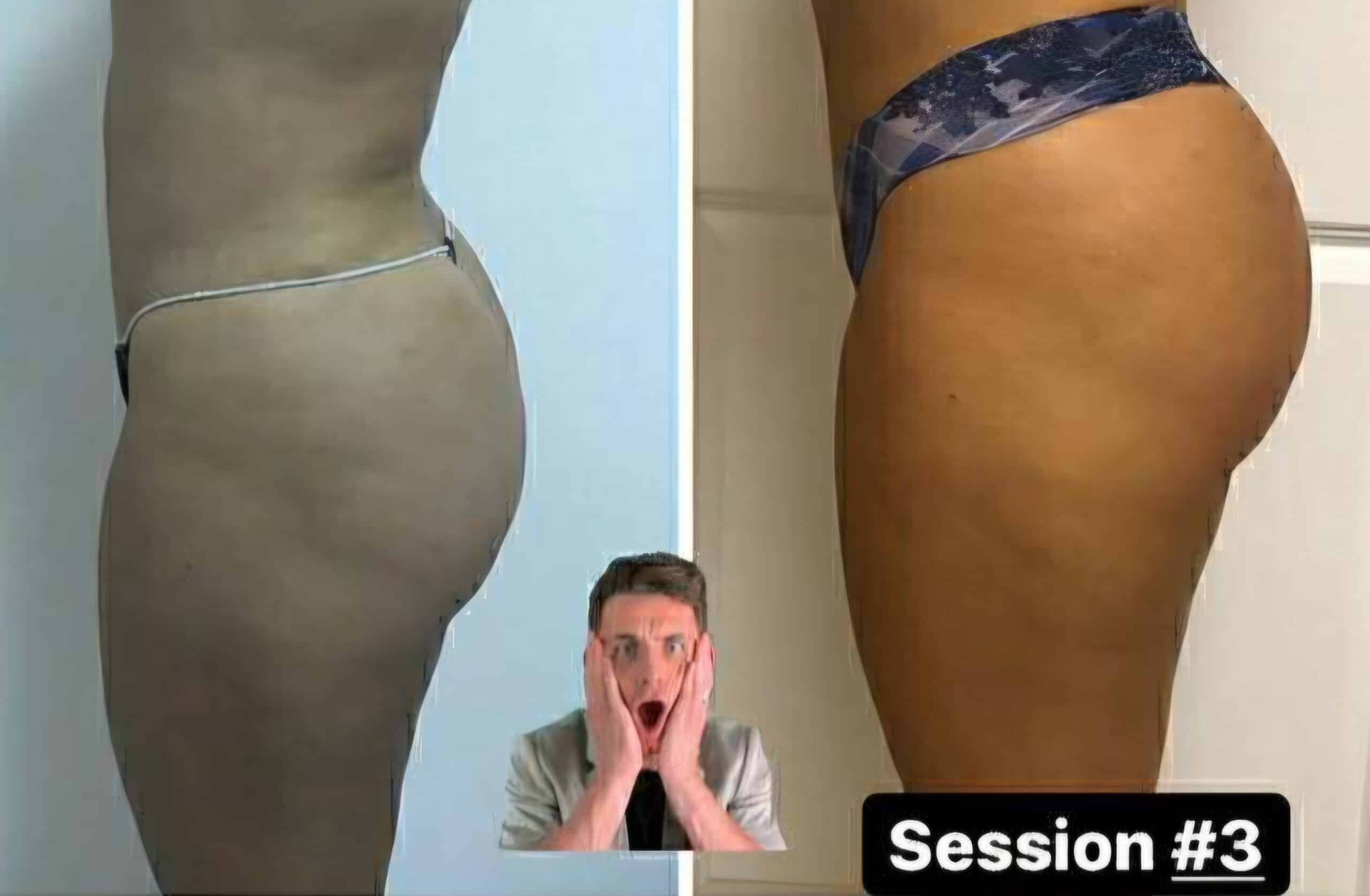 Side-by-side before-and-after photos of a woman’s hip and buttock area in underwear, with a surprised man’s face inset at the bottom center and “Session #3” text in the lower right.