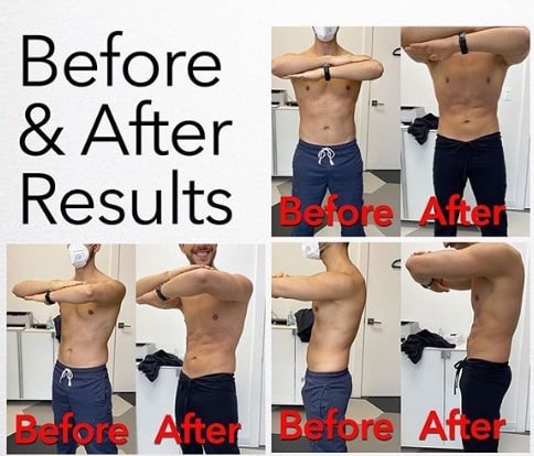 Before-and-after comparison collage of a shirtless man showing torso progress from front and side views, with red “Before” and “After” labels on each photo.
