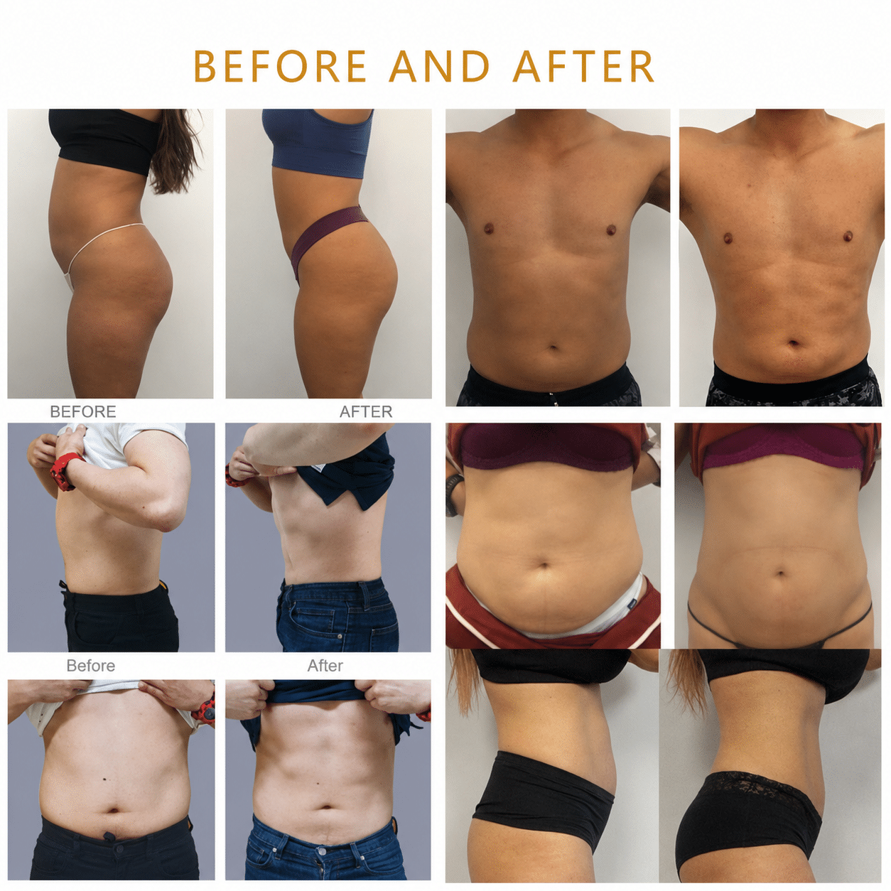 A collage of before-and-after body photos showing sides, torsos, and midsections in underwear and workout clothing against plain backgrounds.