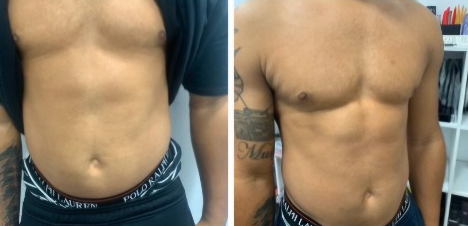 A shirtless man’s torso is shown in a side-by-side comparison, with a tattoo on one upper arm and indoor shelves in the background.