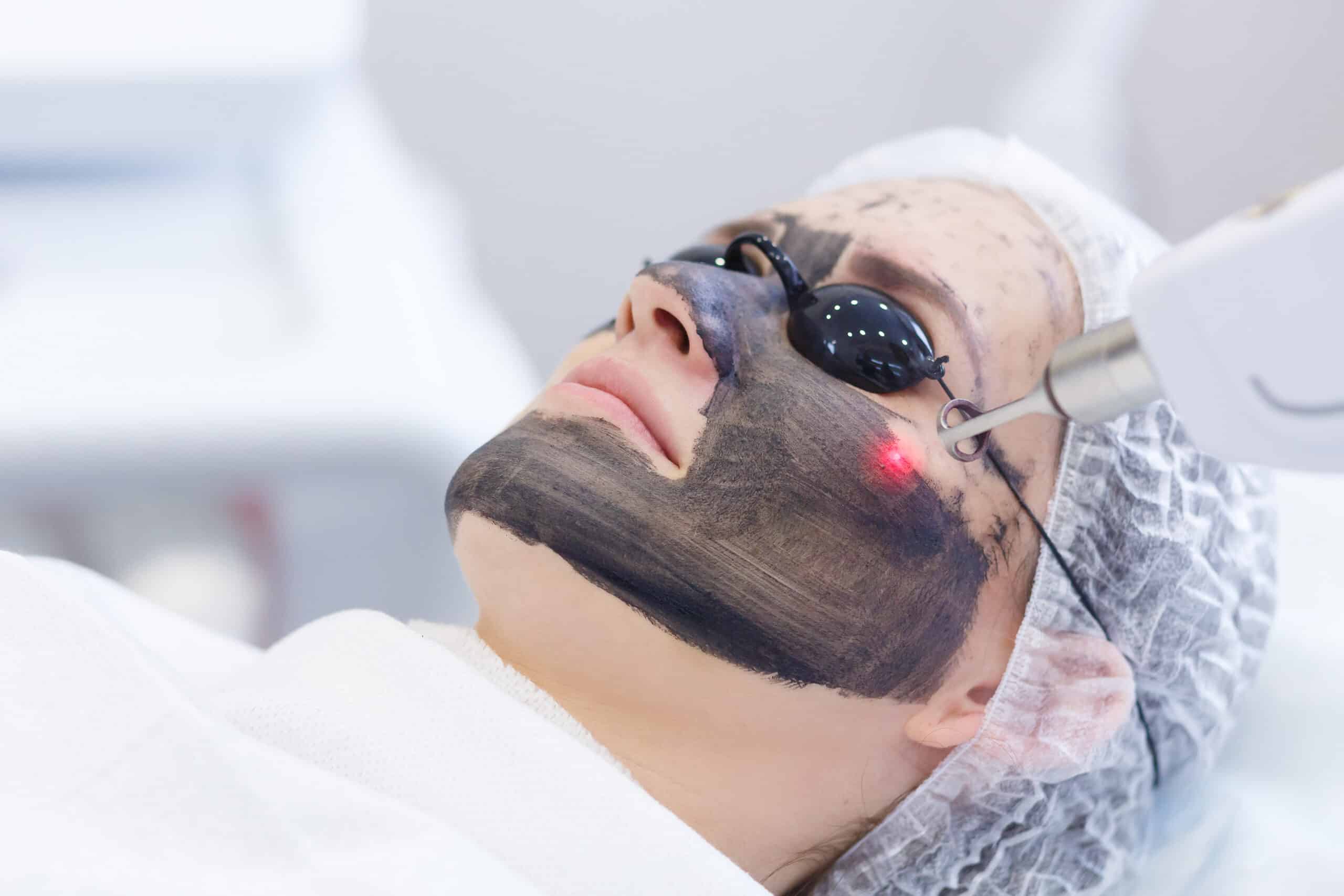 A woman wearing protective goggles and a hairnet receives a facial treatment with a handheld laser device while lying on a treatment bed.