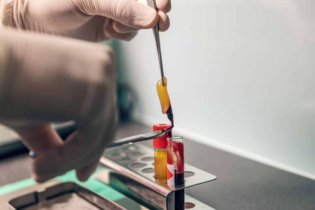 Vampire Facials: What to Know and How to Vet Your Med Spa - Elevate Med Spa Gloved hands use tweezers to handle a small amber and red glass piece above a metal workbench in a workshop.